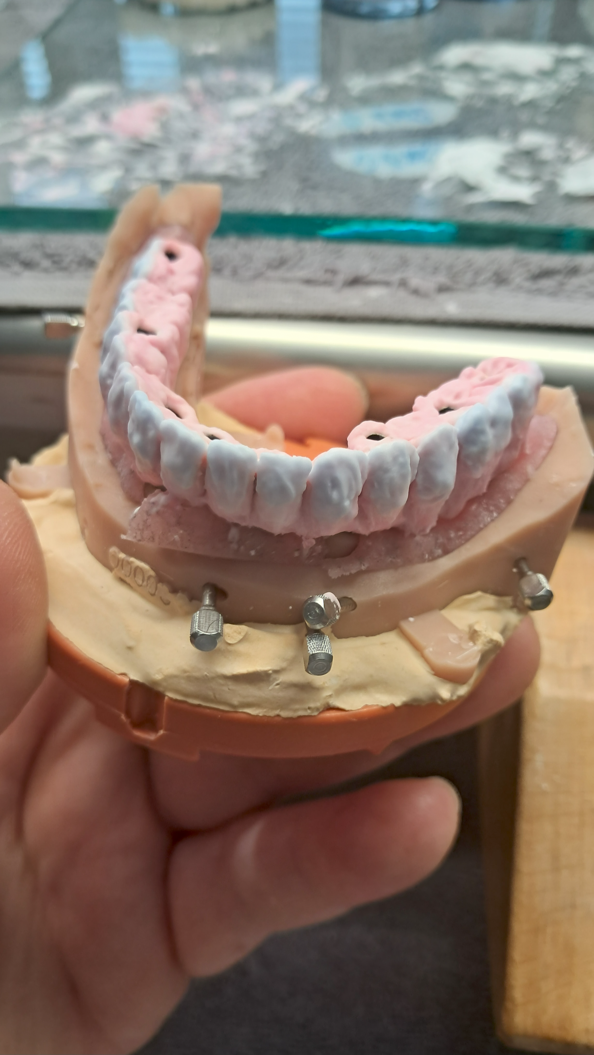 Metodología de trabajo en laboratorio dental